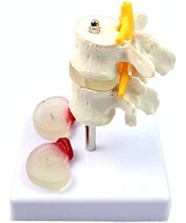 Model of Human Spine Detachable Medical Teaching Model Lumbar Spine Injuries with 2 Intervertebral Disc Model Model