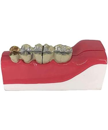 Buy LBYLYH Teeth Adult Replica Model - Realistic Dental Teaching Tool | Removable Tissues for Education & Practice - Buy Online on SooperMarket.com