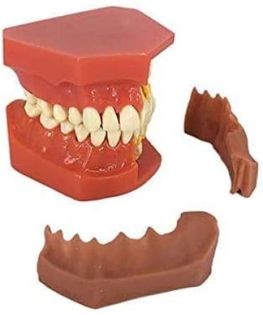 LBYLYH Standard Dental Model - Educational Teeth Model for Children & Adults | Perfect for Studios & Study Tools - Buy Online on SooperMarket.com