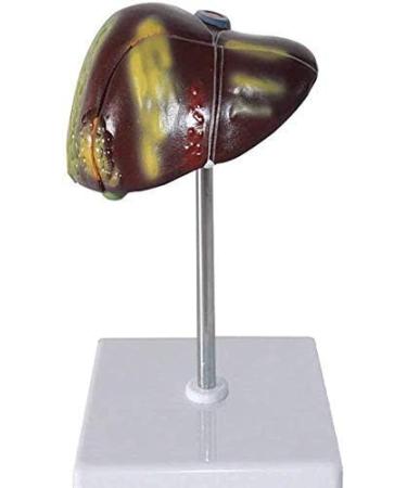 Human Liver Pathological Model with Base On Support Tool Study On Medical Model Internal - Buy Online on SooperMarket.com
