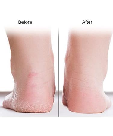 Silicone Moisturizing Socks for Cracked Heels - Foot Care Tool | Anti-Crack Silicone Socks for Soft Hydrated Feet - Buy Online on SooperMarket.com