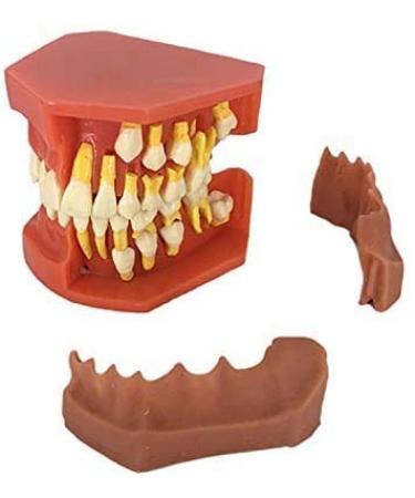 LBYLYH Standard model of the teeth teeth dental model of the Studios system teaches standard model with exchange tooth for children and display for adult study tool