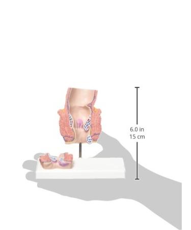 3B Scientific K27 Hemorrhoid Model 5.5-Inchx3.9-Inchx5.5-Inch - Buy Online on SooperMarket.com