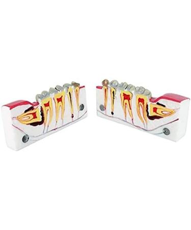Buy LBYLYH Teeth Adult Replica Model - Realistic Dental Teaching Tool | Removable Tissues for Education & Practice - Buy Online on SooperMarket.com