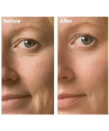 Anti-wrinkle face pearls concentrate for face and eyes with Q10 against skin aging hypoallergenic vegan - Buy Online on SooperMarket.com