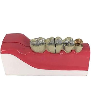 Buy LBYLYH Teeth Adult Replica Model - Realistic Dental Teaching Tool | Removable Tissues for Education & Practice - Buy Online on SooperMarket.com