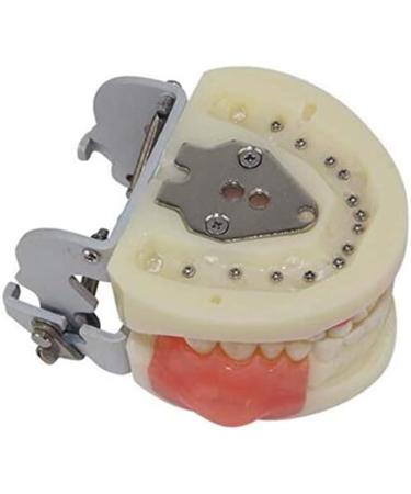 Professional Dental Model for Incision & Drainage of Abscess - Ideal for Students & Educators | International Shipping - Buy Online on SooperMarket.com