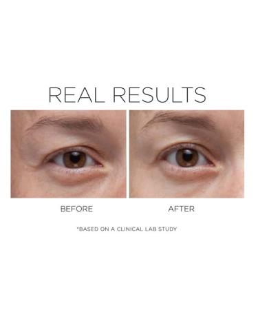 COSMEDIX Opti Crystal Liquid Crystal Eye Serum 0.25 Fl Oz | Reduce Dark Circles | Improve Fine Lines & Wrinkles | Cruelty-Free & Gluten Free - Buy Online on SooperMarket.com