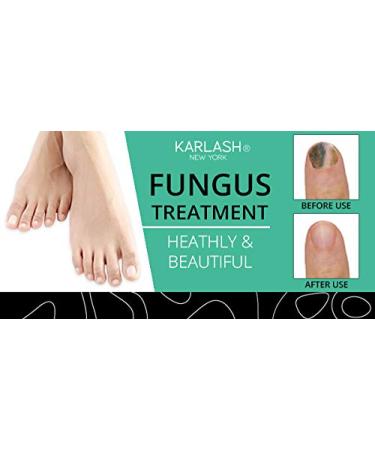 Karlash Extra Strong Nail Fungus Treatment Kit - Made in USA - 0.5oz - For Nails and Toes - Buy Online on SooperMarket.com