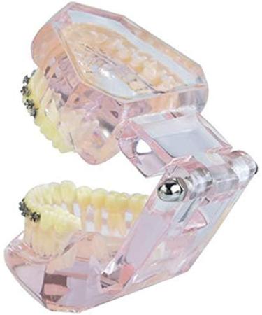 LBYLYH Pink Teeth Model - Orthodontic Dental Studio Educational Toy for Kids - Buy Online on SooperMarket.com