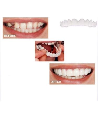 Buy Uqlpxz 2 Pairs Provisional Dental Prosthesis - Affordable Dentures & Cosmetic Teeth for Women & Men - Temporary Veneers & Artificial Teeth - Buy Online on SooperMarket.com