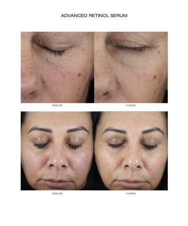 Luxe Retinol with Bakuchiol 5X PM | Anti-Aging Serum for Glowing Skin | Shop Internationally - Buy Online on SooperMarket.com