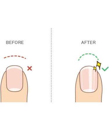 Callus Remover for Feet Heel Scraper Nail File - Foot File Pedicure Tool Foot Scraper Glass Pedicure Foot Buffer for Cracked Heels & Dead Skin - Buy Online on SooperMarket.com