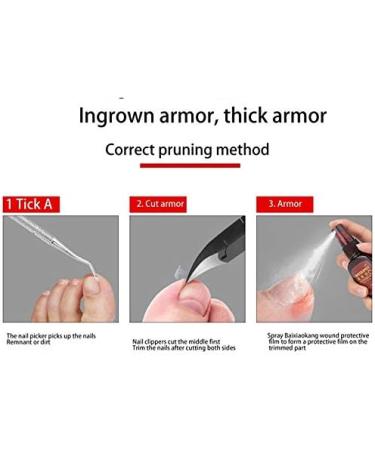 ISTOVO 4Pcs/Lot Paronychia Nail Tools Nail Clipper Nail Correction Thick Nails Ingrown Toenails Nippers Dirt Remover - Buy Online on SooperMarket.com