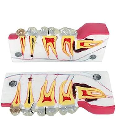 Buy LBYLYH Teeth Adult Replica Model - Realistic Dental Teaching Tool | Removable Tissues for Education & Practice - Buy Online on SooperMarket.com