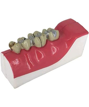 Buy LBYLYH Teeth Adult Replica Model - Realistic Dental Teaching Tool | Removable Tissues for Education & Practice - Buy Online on SooperMarket.com