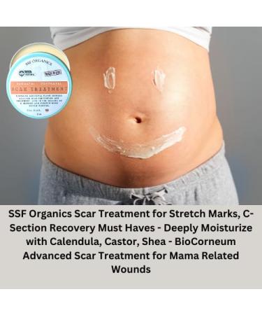 SSF Organics Scar Treatment for Stretch Marks & C-Section Recovery - Deep Moisturizing Formula with Calendula Castor Oil & Shea Butter - Advanced Care for Mama's Skin - Buy Online on SooperMarket.com