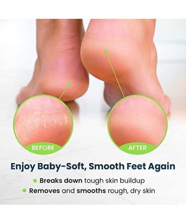 Foot Cure Exfoliator & Callus Remover Pedicure Set - Includes Foot File, Tea Tree Oil Soak, Urea Cream, USA Made - Buy Online on SooperMarket.com