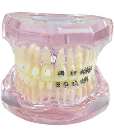 LBYLYH Pink Teeth Model - Orthodontic Dental Studio Educational Toy for Kids - Buy Online on SooperMarket.com