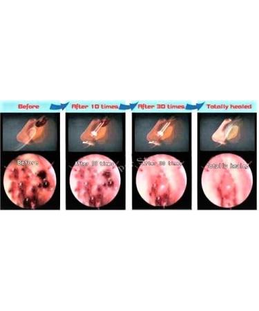 playhair Red Led Light Therapy Device -Cat Dog Horse. Pain Relief Hip Joint Mobility.and Inflammation Relief Advanced Pain Relief - Buy Online on SooperMarket.com