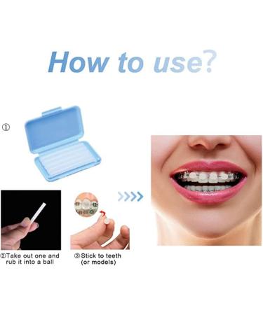 Angzhili 10 Pack Dental Orthodontics Wax for Brace Wearers Gum Protection (Multi-Color) - Buy Online on SooperMarket.com