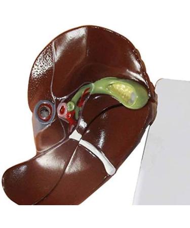 Human Liver Pathological Model with Base On Support Tool Study On Medical Model Internal - Buy Online on SooperMarket.com