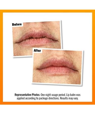 O'Keeffe's Lip Repair Overnight 7g - Overnight Lip Repair Treatment - Buy Online on SooperMarket.com