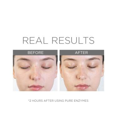 COSMEDIX Pure Enzymes Cranberry Exfoliating Mask - Gentle Exfoliation for Dry Skin | Smooth Texture with L-Lactic Acid & Cranberry Enzymes | Cruelty-Free - Buy Online on SooperMarket.com