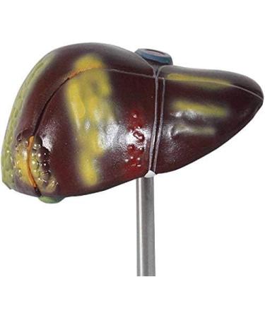 Human Liver Pathological Model with Base On Support Tool Study On Medical Model Internal - Buy Online on SooperMarket.com
