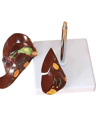 Human Liver Pathological Model with Base On Support Tool Study On Medical Model Internal - Buy Online on SooperMarket.com