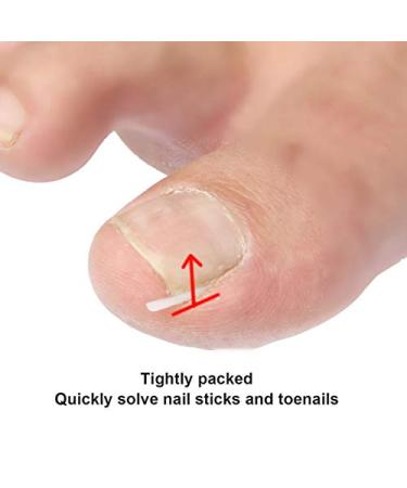 60+2 Pack Ingrown Toenail Treatment Set - Includes Corrector Strips, Lifter, and Nail Clipper - Professional Ingrown Toenail Correction Tool - Buy Online on SooperMarket.com