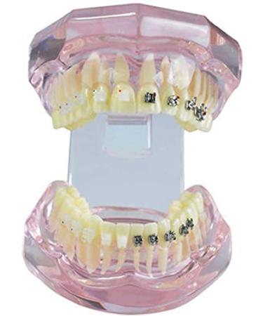 LBYLYH Teeth Model Pink Model Orthodontic Dental Studio or Question Educational Toy Tool