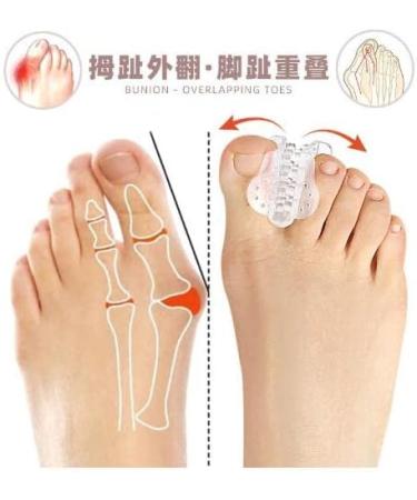 Clear Gel Toe Separators & Straightener for Hammer Toe & Overlapping Hallux Valgus - Correct Crooked Toes - Athletes Foot Pads (One Size) - Buy Online on SooperMarket.com