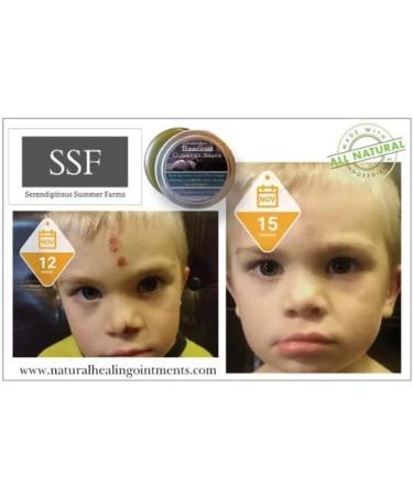 SSF Organic Comfrey Salve - Large 4oz Container for Wounds, Rashes, Skin Conditions, Arthritis, Blisters, Sores, Post Surgery - Buy Online on SooperMarket.com