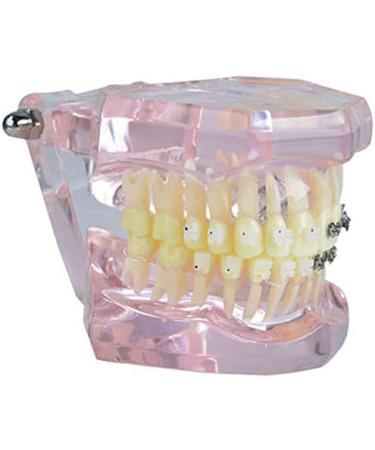LBYLYH Pink Teeth Model - Orthodontic Dental Studio Educational Toy for Kids - Buy Online on SooperMarket.com