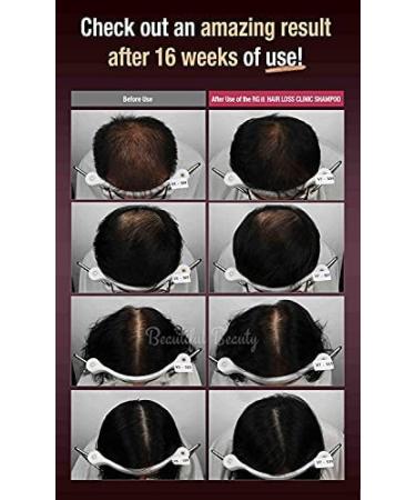 RGIII Premium Red Ginseng Hair Loss Prevention Treatment - Buy Online on SooperMarket.com