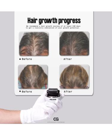 Copenhagen Grooming Hair Growth Accelerator Set for Men | Hair Growth Serum & Dermaroller | 150 Days Supply | Stop Hair Loss - Buy Online on SooperMarket.com