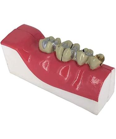 Buy LBYLYH Teeth Adult Replica Model - Realistic Dental Teaching Tool | Removable Tissues for Education & Practice - Buy Online on SooperMarket.com