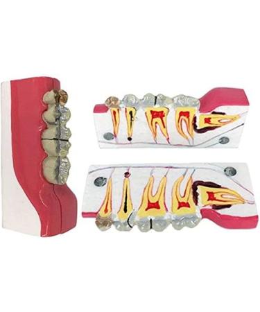Buy LBYLYH Teeth Adult Replica Model - Realistic Dental Teaching Tool | Removable Tissues for Education & Practice - Buy Online on SooperMarket.com