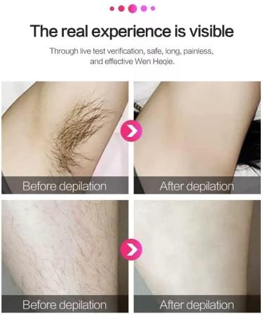 Laser Hair Removal for Women - Permanent Painless IPL Device, Upgraded to 999,999 Flashes, 5 Energy Levels, 2 Modes - Beautify Skin Face Body Bikini - Light Green - Buy Online on SooperMarket.com