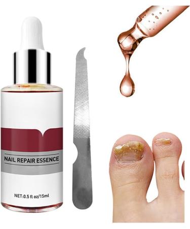 1PC Nail Treatment Toenail Treatment Nail Renewal Solution Toenails & Fingernails Nail Repairs Essential Oil Protects From Discoloration Brittle And Cracked Nail(12ML) - Buy Online on SooperMarket.com