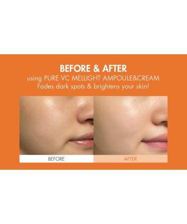 Dr.Ceuracle Pure Vitamin C Mellight Cream | Tone-Up Serum for Face | Anti-Aging Moisturizer | Brighten Dark Spots & Wrinkles | Paraben-Free | Shop Internationally - Buy Online on SooperMarket.com