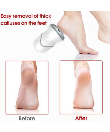 Dajidafu Electronic Foot Callus Remover Professional Heel Grinding Adjustable Feet File Skin Care Tool Home Pedicure Accessories - Buy Online on SooperMarket.com