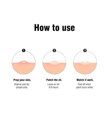 2024 New Acne Cover Patch Spot Stickers for Face & Skin - 36 Patches | Effective Acne Treatment | Fast Shipping Internationally - Buy Online on SooperMarket.com