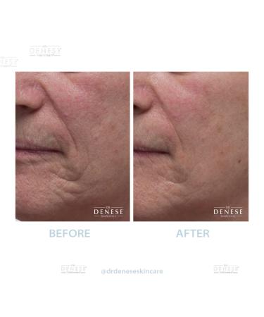 Dr. Denese Collagen Firming Peel Off Mask | Anti-Aging AHA Mask | 4 FL oz for Tightening Skin - Buy Online on SooperMarket.com