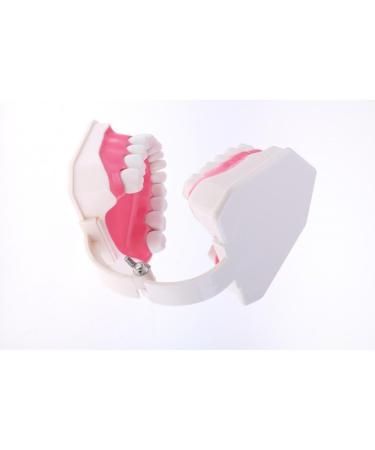 F Fityle 2X Magnification Model Teeth - Removable PVC for Dental Education | International Shipping Available - Buy Online on SooperMarket.com