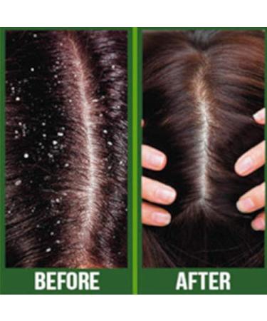 Difeel Premium Castor Plus Tea Tree Hair Oil - Pro-Growth & Scalp Care 2.5 oz - Buy Online on SooperMarket.com