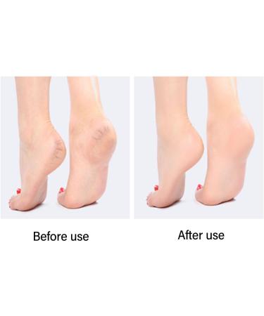 Dekaim Pumice Stone for Feet Foot Scrubber for Dead Skin for Dead Skin Removal Hard Remover Pedicure Prevents Cracked Heels (Grey) - Buy Online on SooperMarket.com