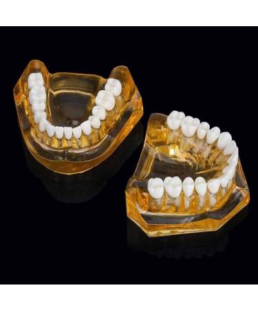 LBYLYH Adult Tooth Replica Model - Medical Dental Teaching Tool for Professionals - International Shipping Available - Buy Online on SooperMarket.com