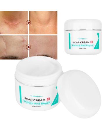 Scar Cream Scar Serum Stretch Marks Removal Skin Repair Cream Scar Removal Cream Scar Removal Cream the skin to improve the skin contour